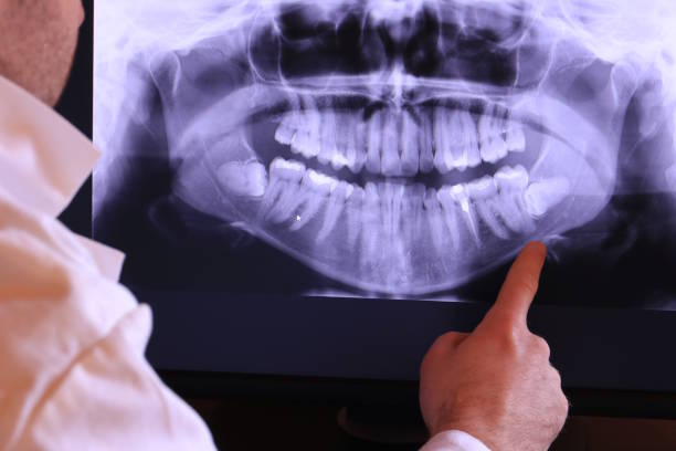 Best Emergency Tooth Extraction in Gonzales, TX
